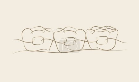 Illustration for Teeth braces illustration drawing in linear style on beige color background - Royalty Free Image