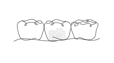 Téléchargez les illustrations : Dents implantées avec dessin d'illustration de pont couronne en style ligne plate sur fond blanc - en licence libre de droit