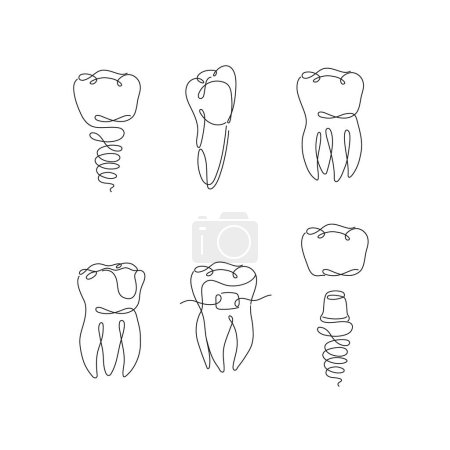 Ilustración de Implante de colección de dientes, tirantes, corona de dientes, dibujo de sello dental en estilo de línea plana sobre fondo blanco - Imagen libre de derechos
