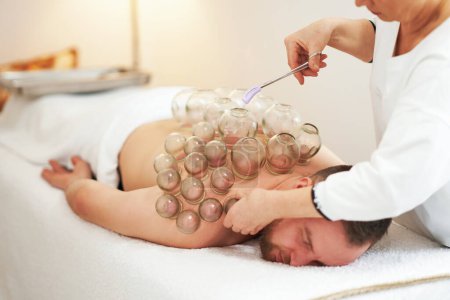 Photo for A picture of a man having cupping therapy. High quality photo - Royalty Free Image