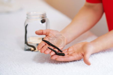 Photo for A group of leeches used for therapy. High quality photo - Royalty Free Image
