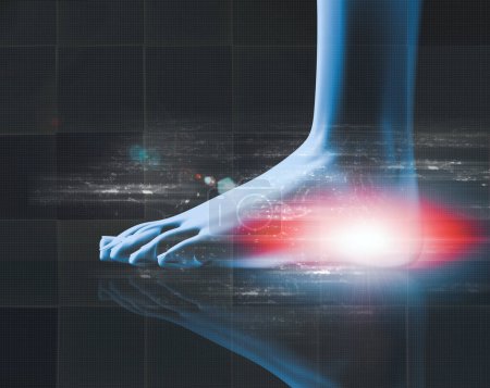 Photo for Medical imaging and medical treatments. Concept of analgesics and muscular pain and inflammation of feet and heel.Human body x-ray background and joint pain. - Royalty Free Image