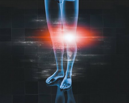 Photo for Medical imaging and medical treatments. Concept of analgesics and muscular pain and inflammation of the knee and meniscus.Human body x-ray background and joint pain. - Royalty Free Image