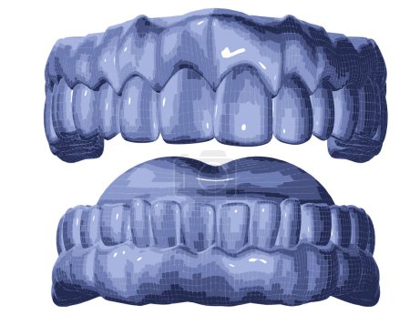 Téléchargez les illustrations : Image 3D du maillage de la prothèse dentaire.Attelles et aligneurs dentaires. - en licence libre de droit