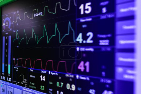 Photo for EKG monitor in intra aortic balloon pump machine in icu on blur background, Brain waves in electroencephalogram, heart rate wave - Royalty Free Image