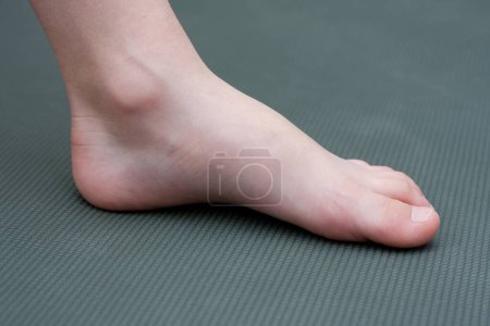 Foto de Child barefoot on mat. Close-up child's foot. Side view. Prevention of flat feet in preschool children. Health care. - Imagen libre de derechos