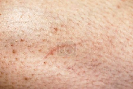 Photo for Wounds from scratches by cat's nails - Royalty Free Image