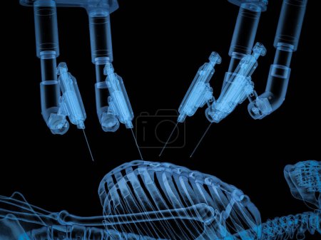 Téléchargez les photos : Machine robotisée de chirurgie assistée par rayons X de rendu 3d avec le patient isolé sur noir - en image libre de droit