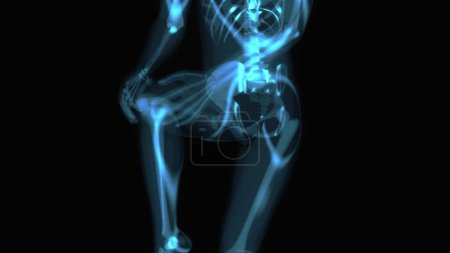 Foto de Ilustración 3D concepto de anatomía abstracta de un dolor de rodilla - Imagen libre de derechos