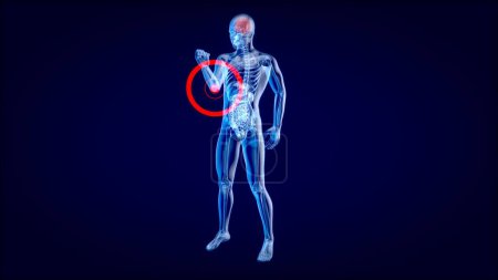 Téléchargez les photos : Concept d'anatomie d'une douleur au coude - en image libre de droit