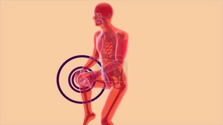 Foto de Concepto de anatomía abstracta 3D de un dolor de rodilla - Imagen libre de derechos