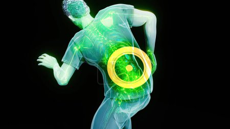 Photo for Abstract illustration of back pain - Royalty Free Image