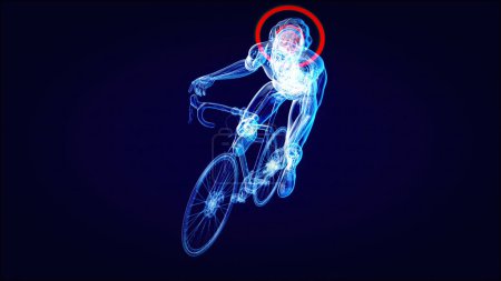 Téléchargez les photos : Illustration abstraite d'un cycliste et d'une commotion cérébrale - en image libre de droit