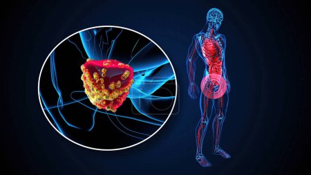 Foto de Resumen Ilustración 3D de la próstata, medicina - Imagen libre de derechos