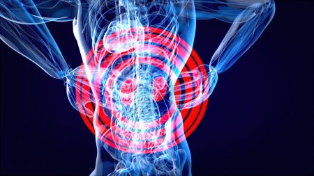 Photo for Abstract  design of back pain and kidneys - Royalty Free Image