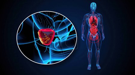  illustration 3D abstraite de la prostate 
