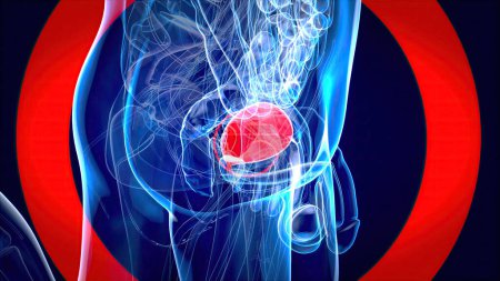 Abstract 3D illustration of the bladder cancer