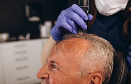un anciano está siendo examinado en una clínica de trasplante de cabello.