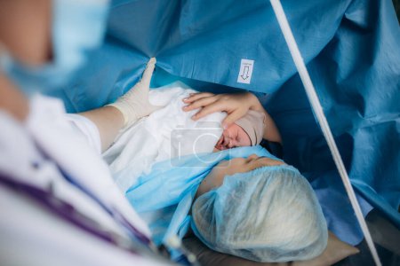 Der erste Blick auf Mutter und ihr Neugeborenes im Operationssaal.