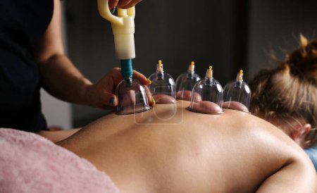 Téléchargez les photos : Procédures avec les ventouses dans un salon de massage spa - en image libre de droit