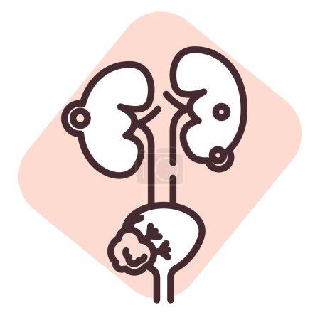 Ilustración de Prostata médica, ilustración o icono, vector sobre fondo blanco. - Imagen libre de derechos
