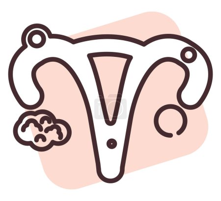 Téléchargez les illustrations : Utérus médical, illustration ou icône, vecteur sur fond blanc. - en licence libre de droit