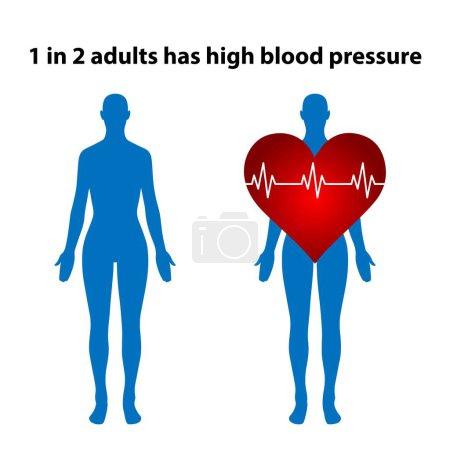 Illustration for Silhouettes of human bodies with a heart shape and the text 1 in 2 adults has high blood pressure - Royalty Free Image