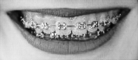 Halftone dotted smile with teeth and braces. Vector textured female lips for trendy y2k retro collage
