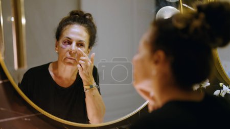 Photo for Middle age hispanic woman using makeup to cover signs of domestic violence at bathroom - Royalty Free Image