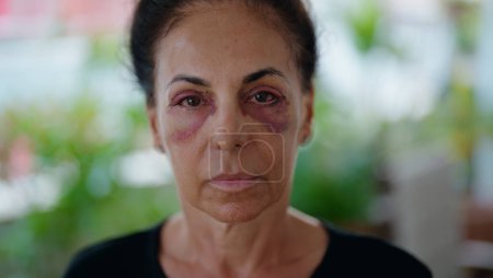 Foto de Mujer hispana de mediana edad que sufre violencia doméstica con moretones en los ojos en la terraza del hogar - Imagen libre de derechos