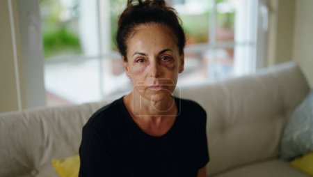 Foto de Mujer hispana de mediana edad que sufre violencia doméstica con moretones en los ojos en casa - Imagen libre de derechos