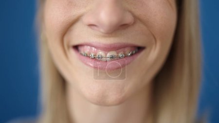 Téléchargez les photos : Young blonde woman smiling confident showing braces over isolated blue background - en image libre de droit