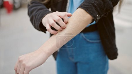 Photo for Young beautiful hispanic woman scratching arm for itchy at street - Royalty Free Image