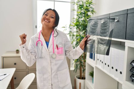 Foto de Joven asiática médico mujer sosteniendo pecho x-ray gritando orgulloso, celebrando victoria y éxito muy emocionado con el brazo levantado - Imagen libre de derechos