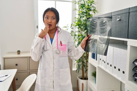 Foto de Joven asiática doctora sosteniendo radiografía de tórax cubriendo la boca con la mano, conmocionada y temerosa de error. expresión sorprendida - Imagen libre de derechos