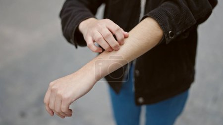 Téléchargez les photos : Jeune belle hispanique femme grattant bras pour démangeaisons à la rue - en image libre de droit