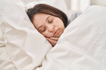 Mujer joven con síndrome de Down acostada en la cama durmiendo en el dormitorio