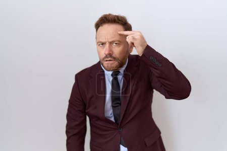 Photo for Middle age business man with beard wearing suit and tie pointing unhappy to pimple on forehead, ugly infection of blackhead. acne and skin problem - Royalty Free Image