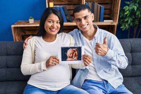 Photo for Young hispanic couple expecting a baby sitting on the sofa showing baby ultrasound smiling happy and positive, thumb up doing excellent and approval sign - Royalty Free Image