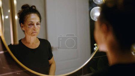 Téléchargez les photos : Moyen Age femme hispanique souffrant de violence domestique regardant un miroir ecchymose sur les yeux à la salle de bain - en image libre de droit