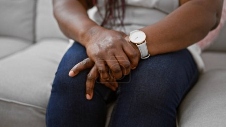 Téléchargez les photos : Femme afro-américaine assise à la maison sur un canapé confortable, souffrant de douleurs au poignet dans les mains tout en essayant de se détendre pendant un après-midi intérieur reposant. - en image libre de droit