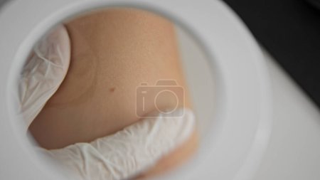 Téléchargez les photos : Jeune femme blonde dermatologue examinant la taupe de peau à la clinique - en image libre de droit