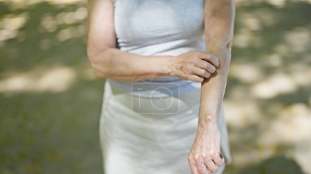 Téléchargez les photos : Femme d'âge moyen se gratter le bras au parc - en image libre de droit
