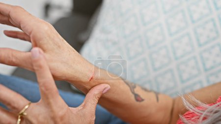 Téléchargez les photos : Femme blessée, une saga de mains douloureuses touchant le poignet blessé assis sur le canapé à la maison, style de vie intérieur apporte des problèmes inattendus - en image libre de droit