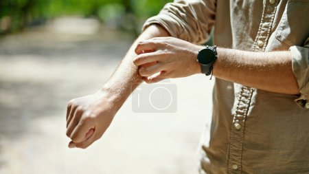 Téléchargez les photos : Jeune homme hispanique se gratter le bras au parc - en image libre de droit