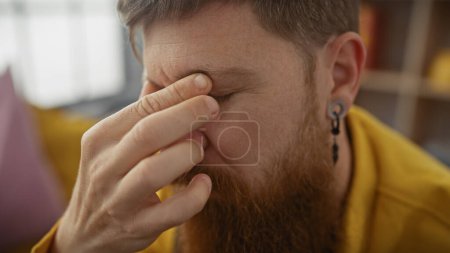 Redheaded bearded man in yellow shirt pressing fingers against bridge of nose, feeling stressed