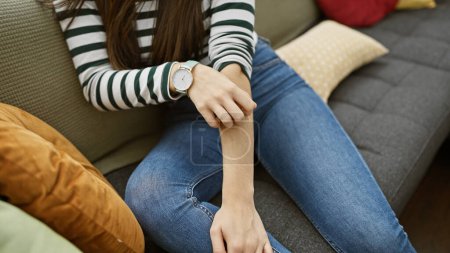 Photo for Hispanic woman scratching arm while sitting on a striped couch indoors, showing discomfort or itchiness. - Royalty Free Image