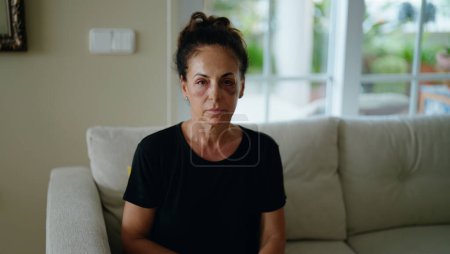Hispanische Frau mittleren Alters leidet unter häuslicher Gewalt mit blauen Flecken auf den Augen zu Hause