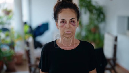 Hispanische Frau mittleren Alters leidet unter häuslicher Gewalt mit blauen Flecken auf den Augen auf der heimischen Terrasse