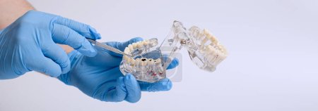 Téléchargez les photos : Technicien dentaire tenant un modèle de mâchoire dentaire sur un fond blanc. - en image libre de droit